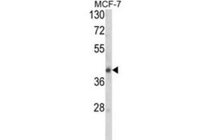 Western Blotting (WB) image for anti-serpin Peptidase Inhibitor, Clade A (Alpha-1 Antiproteinase, Antitrypsin), Member 9 (SERPINA9) antibody (ABIN3004177) (SERPINA9 antibody)