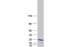 Validation with Western Blot (HPCAL1 Protein (Transcript Variant 1) (Myc-DYKDDDDK Tag))