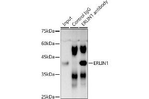 Immunoprecipitation analysis of 300 μg extracts of DU145 cells using 3 μg ERLIN1 antibody (ABIN7267005). (ERLIN1 antibody  (AA 259-348))