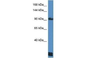 Western Blot showing DSG3 antibody used at a concentration of 1 ug/ml against HepG2 Cell Lysate (Desmoglein 3 antibody  (C-Term))