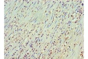 Immunohistochemistry of paraffin-embedded human epityphlon tissue using ABIN7145182 at dilution of 1:100 (CD20 antibody  (AA 209-297))