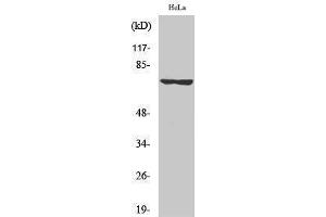 Western Blotting (WB) image for anti-LIMK-1/2 (pThr505), (pThr508) antibody (ABIN3182477) (LIMK-1/2 (pThr505), (pThr508) antibody)