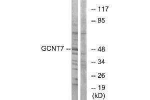 Immunohistochemistry analysis of paraffin-embedded human ovary tissue using GCNT7 antibody. (GCNT7 antibody)