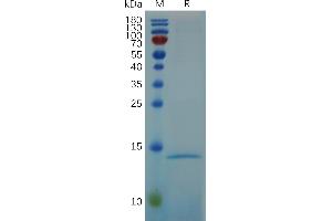 RNASE4 Protein (AA 29-147) (His tag)