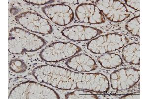 Immunoperoxidase of monoclonal antibody to CIB1 on formalin-fixed paraffin-embedded human colon. (CIB1 antibody  (AA 1-191))