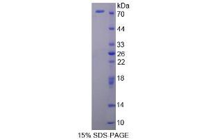 Image no. 1 for FK506 Binding Protein 4, 59kDa (FKBP4) (AA 2-459) protein (His tag,GST tag) (ABIN4990260) (FKBP4 Protein (AA 2-459) (His tag,GST tag))