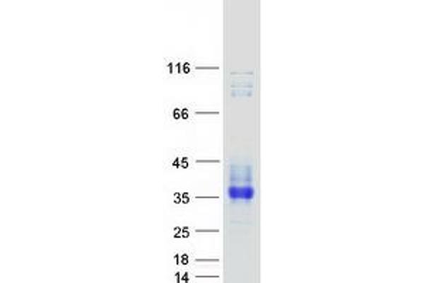 SCN4B Protein (Transcript Variant 1) (Myc-DYKDDDDK Tag)