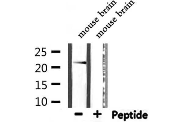 CYBA antibody  (N-Term)