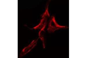 ABIN6275115 staining HuvEc cells by IF/ICC. (KDELR2 antibody  (Internal Region))