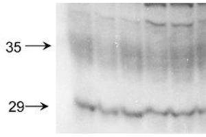 Aquaporin 2 Western Blot. (AQP2 antibody  (C-Term))