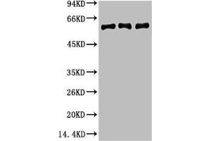 Western blot analysis of 1) Hela, 2) Mouse Brain Tissue, 3) Rat Brain tissue, diluted at 1:2000. (Vimentin antibody)