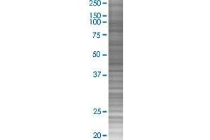 EPB41 transfected lysate. (EPB41 293T Cell Transient Overexpression Lysate(Denatured))