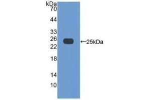 Detection of Recombinant Bax, Porcine using Polyclonal Antibody to Bcl2 Associated X Protein (Bax) (BAX antibody  (AA 2-192))