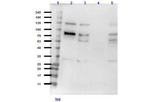 Western Blot of Chicken Anti-PLK1 Antibody Western Blot of Chicken Anti-PLK1 Antibody. (PLK1 antibody)