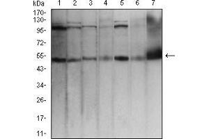 Western blot analysis using TFAP2A mouse mAb against Hela (1), MCF-7 (2), Cos7 (3), A431 (4), HCT116 (5), NIH/3T3 (6), and PC12 (7) cell lysate. (TFAP2A antibody  (AA 1-100))