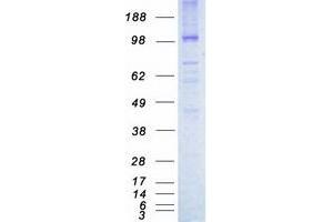 Validation with Western Blot (TIE1 Protein (Myc-DYKDDDDK Tag))