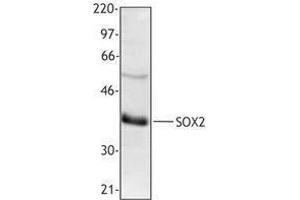 Western Blotting (WB) image for anti-SRY (Sex Determining Region Y)-Box 2 (SOX2) (N-Term) antibody (ABIN2666209) (SOX2 antibody  (N-Term))