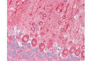 Mouse Brain, Cerebellum: Formalin-Fixed, Paraffin-Embedded (FFPE) (TRAF6 antibody  (AA 1-305))