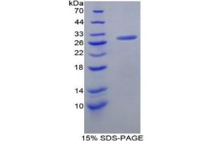 SDS-PAGE (SDS) image for Caspase 8 (CASP8) ELISA Kit (ABIN6574227)