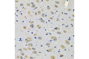 Immunohistochemistry of paraffin-embedded rat brain using TXNDC5 Antibody. (TXNDC5 antibody  (AA 1-324))