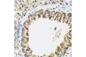 Immunohistochemistry of paraffin-embedded mouse lung using STAT3 antibody (ABIN1876697) at dilution of 1:100 (40x lens). (STAT3 antibody)