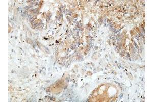 IHC analysis of formalin-fixed paraffin-embedded fetal lung, using TTC25 antibody (1/100 dilution). (TTC25 antibody  (AA 47-236))