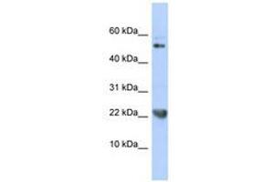 Image no. 1 for anti-Tumor Necrosis Factor (Ligand) Superfamily, Member 12 (TNFSF12) (AA 35-84) antibody (ABIN6740497) (TWEAK antibody  (AA 35-84))