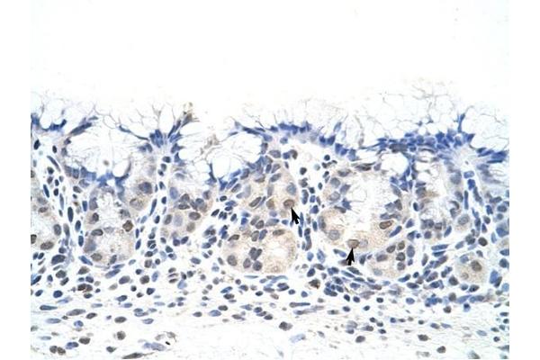 DAZ4 antibody  (N-Term)