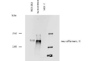 Western blotting analysis of human neurofilament H protein using mouse monoclonal antibody NF-05 on lysates of HEK-293 cell line, human brain lysate, and MCF-7 cell line (neurofilament non-expressing cell line, negative control) under reducing conditions. (NEFH antibody)