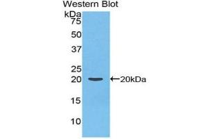 Detection of Recombinant F2, Rat using Polyclonal Antibody to Coagulation Factor II (F2) (Prothrombin antibody  (AA 44-200))