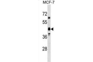 Western Blotting (WB) image for anti-Olfactory Receptor, Family 5, Subfamily M, Member 8 (OR5M8) antibody (ABIN3000577) (OR5M8 antibody)