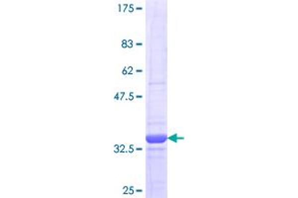 LZTFL1 Protein (AA 39-120) (GST tag)