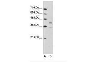 Image no. 1 for anti-DNA Fragmentation Factor, 45kDa, alpha Polypeptide (DFFA) (N-Term) antibody (ABIN203383) (DFFA antibody  (N-Term))