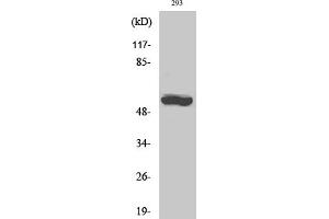 Western Blot analysis of 293 cells using CYP19A1 Polyclonal Antibody diluted at 1:1000. (Aromatase antibody  (AA 190-270))