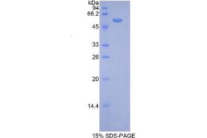 SDS-PAGE analysis of Mouse Ribophorin I Protein. (RPN1 Protein)