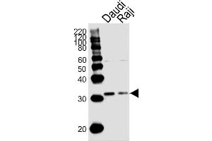 Lane 1: Daudi Cell lysates, Lane 2: Raji Cell lysates, probed with BCL10 (1185CT13. (BCL10 antibody)