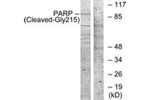 Western blot analysis of extracts from NIH-3T3 cells, treated with etoposide 25uM 1h, using PARP (Cleaved-Gly215) Antibody. (PARP1 antibody  (Cleaved-Gly215))