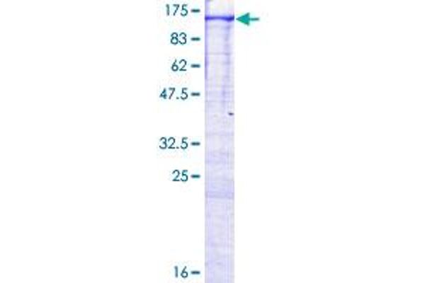 MAP3K14 Protein (AA 1-947) (GST tag)