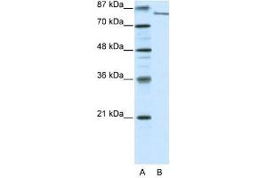 FBXL11 antibody used at 0. (KDM2A antibody  (N-Term))