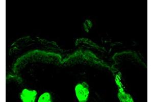 Calreticulin Immunofluorescence. (Calreticulin antibody)