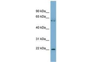 Image no. 1 for anti-Slowmo Homolog 2 (SLMO2) (AA 35-84) antibody (ABIN6742141) (SLMO2 antibody  (AA 35-84))