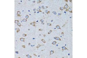 Immunohistochemistry of paraffin-embedded rat brain using RARS antibody (ABIN6127449, ABIN6146708, ABIN6146709 and ABIN6221913) at dilution of 1:100 (40x lens). (RARS antibody  (AA 1-300))