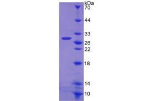 SDS-PAGE analysis of Human WASP Protein. (WASP Protein)