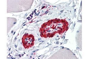 Anti-ACTA2 antibody IHC of human vessels. (Smooth Muscle Actin antibody  (AA 1-378))