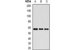 Western blot analysis of ALPP expression in HepG2 (A), rat testis (B), rat liver (C) whole cell lysates. (PLAP antibody)