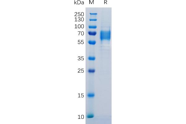 IL-6 Receptor Protein (AA 20-365) (His tag)