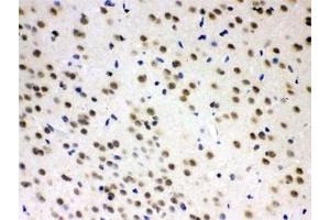 IHC testing of FFPE rat brain with AZIN2 antibody at 1ug/ml. (ADC antibody)