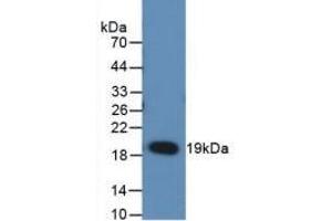 Detection of Recombinant RANkL, Rat using Monoclonal Antibody to Receptor Activator Of Nuclear Factor Kappa B Ligand (RANkL) (RANKL antibody  (AA 106-240))