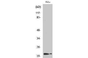 Western Blotting (WB) image for anti-Cyclin-Dependent Kinase Inhibitor 1A (p21, Cip1) (CDKN1A) (pThr145) antibody (ABIN3172948) (p21 antibody  (pThr145))