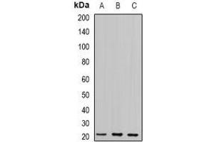 Western blot analysis of Glyoxalase I expression in 22RV1 (A), PC3 (B), mouse kidney (C) whole cell lysates. (GLO1 antibody)